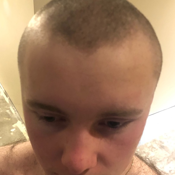 Meet your Posher, Rory - Picture 1 of 1